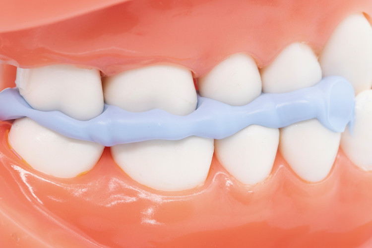 بایت رجیستر - Perfit Bite Registration
