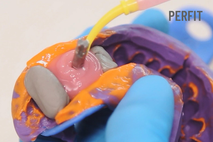 جینجیوال ماسک vincismile PERFIT Gingiva mask