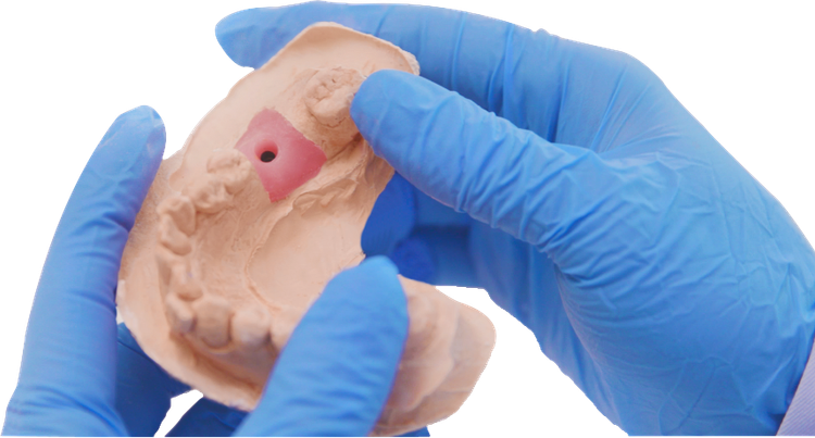 جینجیوال ماسک vincismile PERFIT Gingiva mask