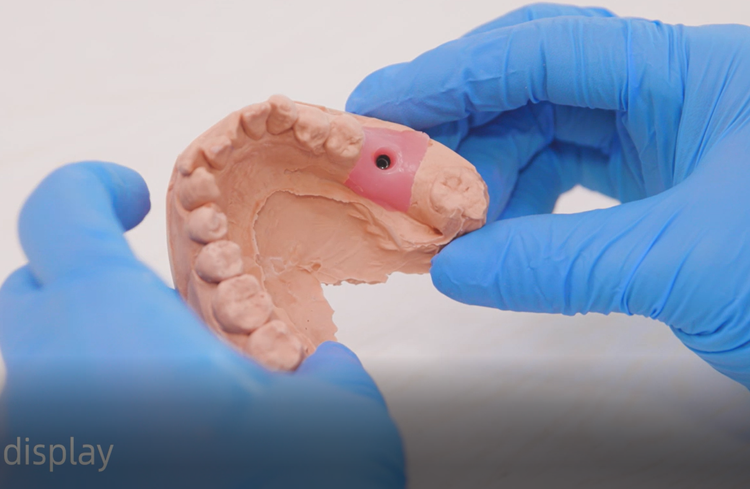 جینجیوال ماسک vincismile PERFIT Gingiva mask