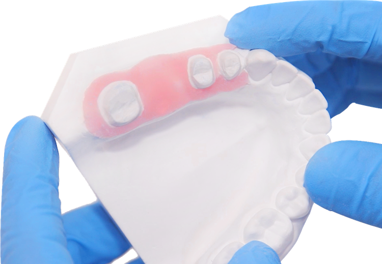 جینجیوال ماسک vincismile PERFIT Gingiva mask