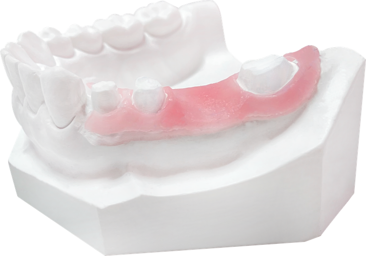 جینجیوال ماسک vincismile PERFIT Gingiva mask