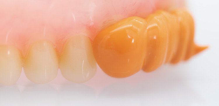 واش قالبگیری لایت بادی vincismile PERFIT Light Body